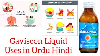 gavisçon syrup uses in urdu Hindi [upl. by Wolram]