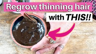 Regrow your thinning edges with this super simple hair growth mask [upl. by Ammon]