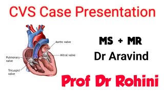 Clinical Cardiology  Lec 6 Mitral stenosis  Dr Mahmoud Allam [upl. by Girhiny]