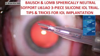 Bausch amp Lomb Sofport LI61AO Trial Tips amp Tricks for Easy amp Consistent IOL Implantation [upl. by Orpah]