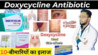 Doxycycline  एंटीबायोटिक  Medicine  Treatment  Antibiotics  doxycycline medicine Used [upl. by Evanthe]