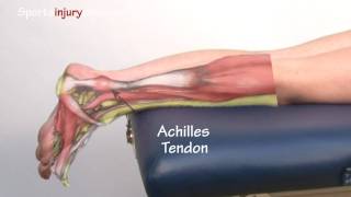 Achilles Tendonitis  Tendinopathy  Explained in 90 Seconds [upl. by Adnirolc]