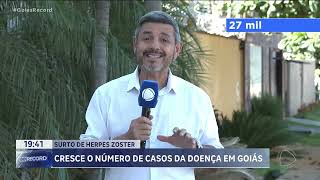 SURTO DE HERPES ZOSTER [upl. by Imim246]