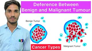 Deference Between Benign and Malignant Cancer  Characteristics of Benign and Malignant Cell Hindi [upl. by Olnek622]