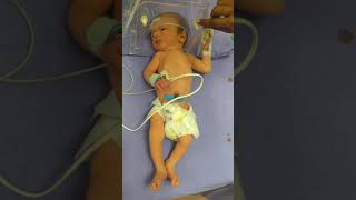 Medical Education Video Neonatology Newborn Seizures [upl. by Philina446]