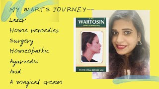 Wartosin review  best wart removal cream  laser surgery Ayurveda homeopathic home remedies [upl. by Skolnik]