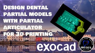 exocad model creator partial model and articulator [upl. by Waldon839]