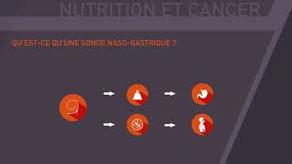 Questce quune sonde nasogastrique SNG [upl. by Hubey]