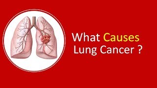 What Causes Lung Cancer Dr Arvind Kumar  Medanta Gurgaon 919773635888 [upl. by Aeriela]