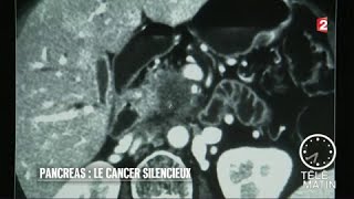 Santé  Pancréas  le cancer du silence [upl. by Jemina]