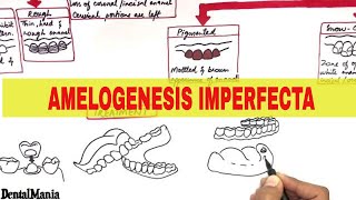 Amelogenesis Imperfecta  Pathogenesis Types Clinical features and Treatment [upl. by Ysset]