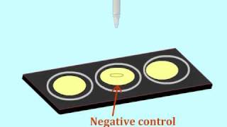 Agglutination assay to detect antigens  MultiLingual Captions [upl. by Aidnama]