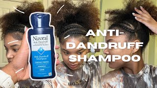 Dry Scalp and Dandruff Treatment Natural Hair  Nizoral AntiDandruff Shampoo [upl. by Pet]