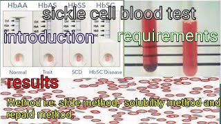 sickle or sickling disease or cell anemia test [upl. by Dryfoos903]