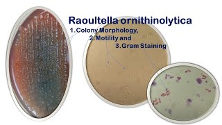 Raoultella ornithinolytica Colony Morphology Motility and Gram Staining [upl. by Petrina]