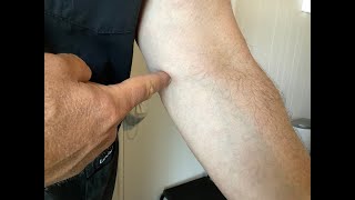 Golfers Elbow vs Tennis Elbow Easy tip on remembering [upl. by Santa]