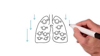 Everything you need to know about the ventilation perfusion ratio [upl. by Henn]