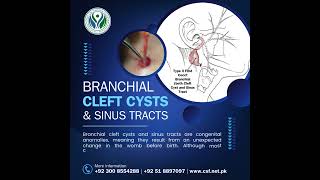 Branchial Cleft Cysts and Sinus treatment HealthcareInnovation BranchialCleftCysts SinusTreatment [upl. by Anilesor448]