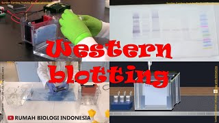 Western Blotting Theory amp Lab Procedure [upl. by Acinomahs]