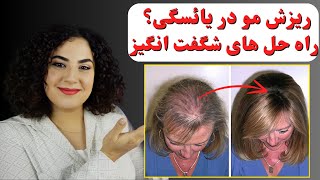 درمان ریزش مو در دوران یائسگی Menopausal Hair Loss [upl. by Deni354]