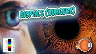 Bioptics surgery  Your EYEBALLS  EYNTK 👁️💉😳💊🔊💯✅ [upl. by Bish235]