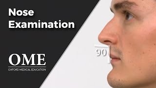 Nose Examination Inspection  ENT [upl. by Pete565]