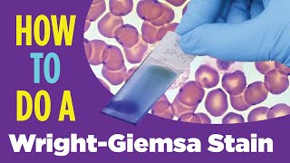 How to do a hematology stain WrightGiemsa stain Laboratory Tutorial Procedure [upl. by Toddy]