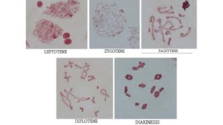 LACTOPROPIONICORCEIN STAINED GRASSHOPPER MEIOTIC CELL DIVISION STAGES PROPHASE 1 [upl. by Ailaham]