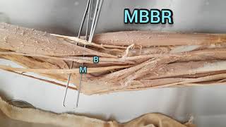 Cubital fossa  Boundaries contents and Clinical Anatomy [upl. by Dustman]