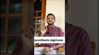 Acanthosis nigricans diabetes acanthosisnigricans insulinresistance usmle plab fmge [upl. by Mahtal890]