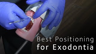 Best Positioning for Minimally Invasive Exodontia [upl. by Demmer]