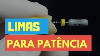 AS 3 LIMAS SENSACIONAIS PARA DAR PATÊNCIA  QUICK TIP ENDOLOVERS [upl. by Mindi]