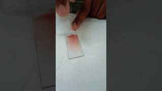 Making a peripheral blood smear  blood smear preparation  prepare a perfect blood smearHematology [upl. by Naujit663]