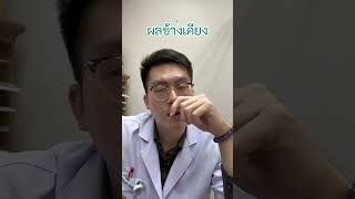 ยา Risperidone part22 เทรนด์วันนี้ antipsychotics schizophrenia จิตเภท ซึมเศร้า [upl. by Aissirac]