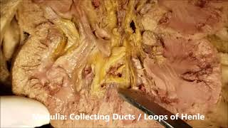 RENAL CORTEX MEDULLA CALICES and CARBUNCLE Dissection by MD Students  Sanjoy Sanyal [upl. by Areem113]