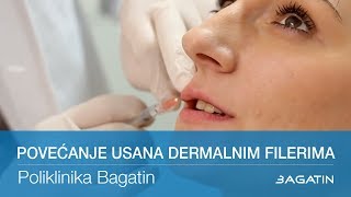 Povećanje usana dermalnim filerima [upl. by Ahsatsana287]