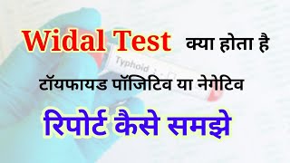 Widal test report reading in hindi  Widal test positive report  Widal Test in hindi [upl. by Maice213]