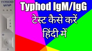 TyphiDot test IgMamp IgG Antibody  Typhoid blood test in hindi  TyphiDot Antibody test [upl. by Aneleairam450]