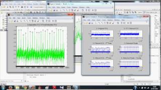 ECG Signal Processing in MATLAB  Detecting RPeaks Full [upl. by Noseaj]