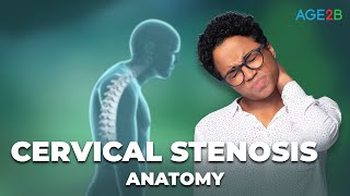 What is Cervical Stenosis  Best Cervical Stenosis Exercises amp Stretches  Spinal Stenosis [upl. by Eimaj]