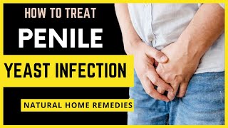 Penile Yeast Infection  How to Treat Infection Natural Home Remedies [upl. by Noryk]