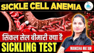 Sickle cell Anemia in hindi  Sickle cell test  Hematology Lecture  MLT Education Point [upl. by Montfort]