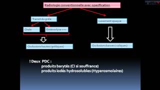 Apport de limagerie dans les occlusions intestinales aigues de ladulte [upl. by Deragon]