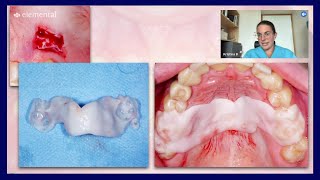 Elemental  Case Commentary with Dr Kristina Bertl [upl. by Legin]