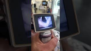 Video laryngoscopy [upl. by Yelehsa]