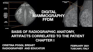 ARTIFACTS IN MAMMOGRAPHY CORRELATED TO THE PATIENT BASIS OF RADIOGRAPHIC ANATOMY VIDEO 1 [upl. by Notsle670]