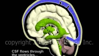 Hydrocephalus and Cerebrospinal Fluid CSF circulation by Dr Cal Shipley MD [upl. by Ayhtak]