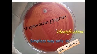 Streptococcus pyogenes identification [upl. by Carmon]