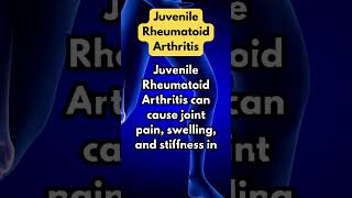 Juvenile Rheumatoid Arthritis [upl. by Lecrad]