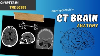 CT BRAIN Chapter1 Brain Lobes [upl. by Duarte]